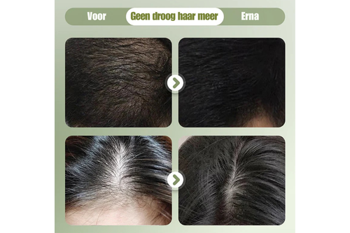 Nature Boost Haarversterker